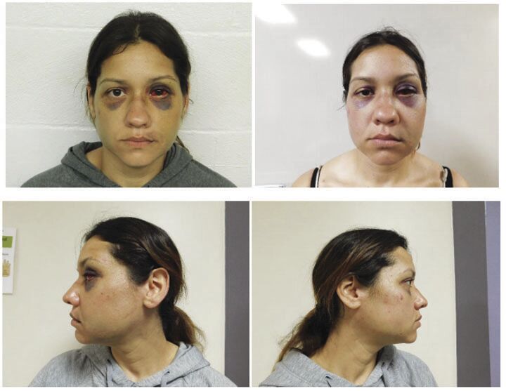 Plea deals to be offered in decapitation/murder